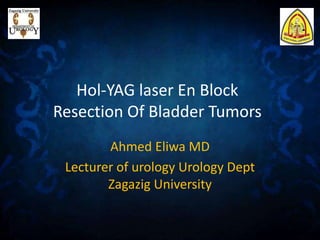 Hol-YAG laser En Block
Resection Of Bladder Tumors
Ahmed Eliwa MD
Lecturer of urology Urology Dept
Zagazig University
 