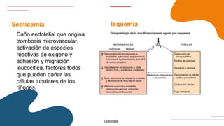 Septicemia
Daño endotelial que origina
trombosis microvascular,
activación de especies
reactivas de oxigeno y
adhesión y migración
leucocitica, factores todos
que pueden dañar las
células tubulares de los
riñones.
Isquemia
Uptodate
 