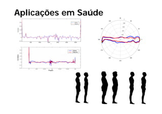 Aplicações em Saúde                90
                                               1
                             120                   60
                                           0.8


                                          0.6
                       150                               30
                                         0.4
                                         04


                                         0.2


                 180                                           0




                       210                               330




                             240                   300

                                   270
 