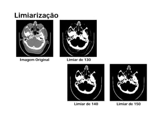 Limiarização
         ç




 Imagem Original   Limiar de 130




                      Limiar de 140   Limiar de 150
 
