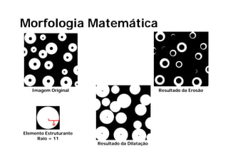 Morfologia Matemática




   Imagem Original                               Resultado da Erosão




            R

Elemento Estruturante
     Raio = 11
                        Resultado da Dilatação
 