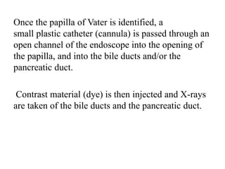 Once the papilla of Vater is identified, a
small plastic catheter (cannula) is passed through an
open channel of the endoscope into the opening of
the papilla, and into the bile ducts and/or the
pancreatic duct.
Contrast material (dye) is then injected and X-rays
are taken of the bile ducts and the pancreatic duct.
 