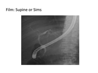 Film: Supine or Sims
 
