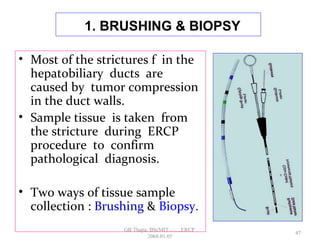 1. BRUSHING & BIOPSY
• Most of the strictures f in the
hepatobiliary ducts are
caused by tumor compression
in the duct walls.
• Sample tissue is taken from
the stricture during ERCP
procedure to confirm
pathological diagnosis.
• Two ways of tissue sample
collection : Brushing & Biopsy.
47
GB Thapa, BScMIT.........ERCP
2068.01.05
 