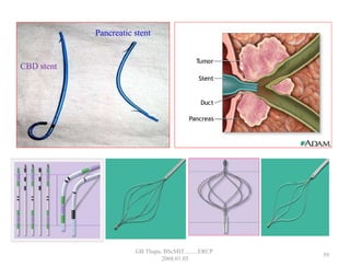 Pancreatic stent
CBD stent
59
GB Thapa, BScMIT.........ERCP
2068.01.05
 