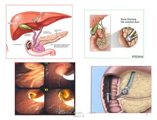 74
GB Thapa, BScMIT.........ERCP
2068.01.05
 