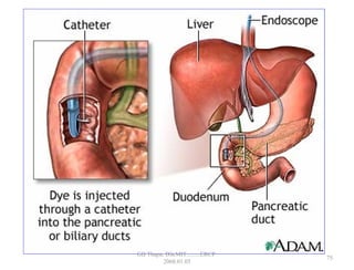 75
GB Thapa, BScMIT.........ERCP
2068.01.05
 
