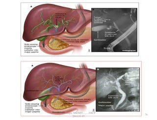 76
GB Thapa, BScMIT.........ERCP
2068.01.05
 
