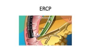 ERCP
 