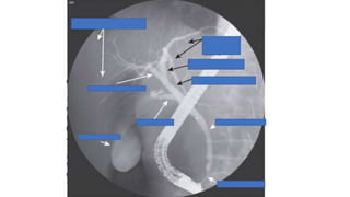 ERCP.pptx