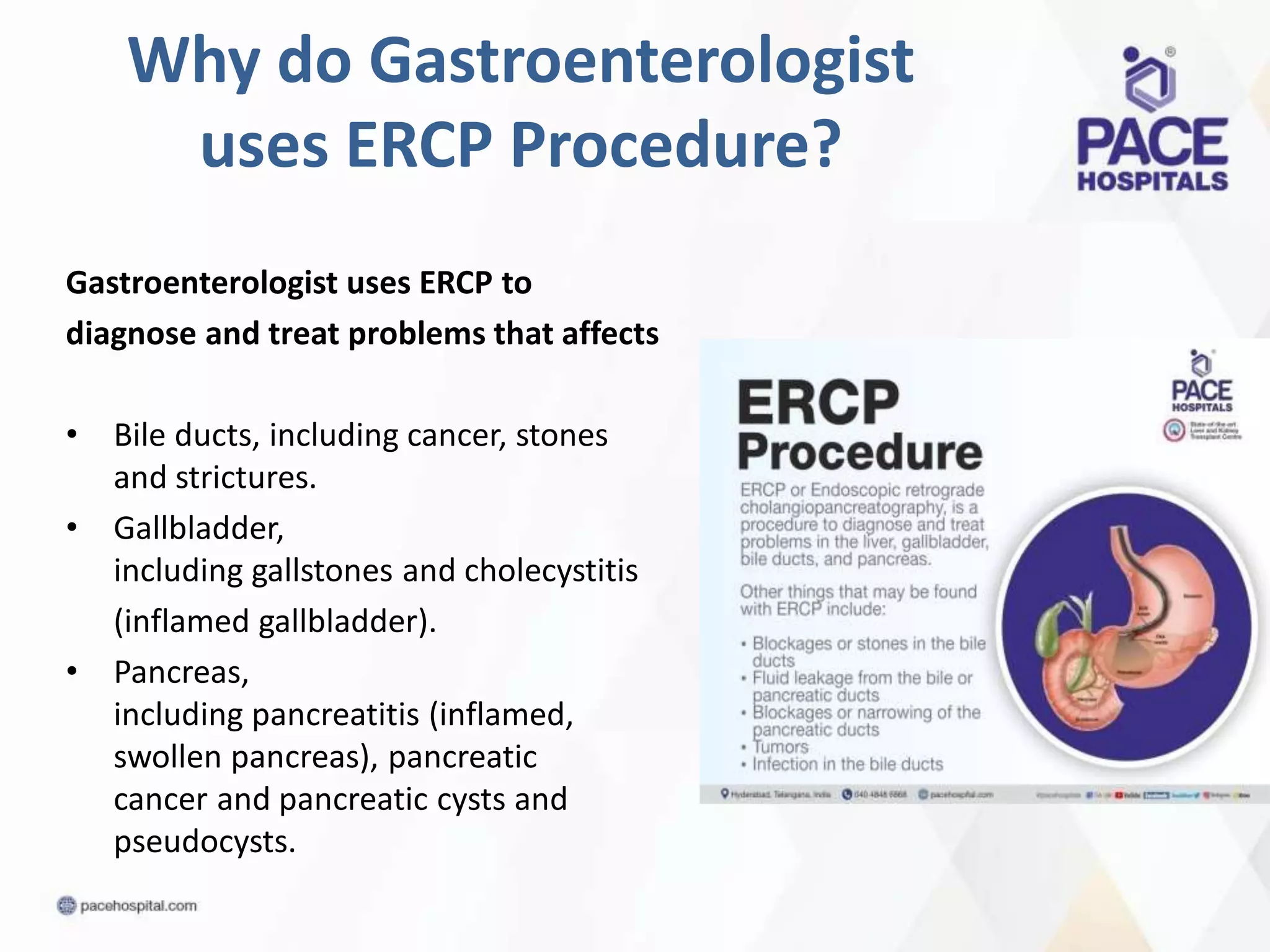 Why do Gastroenterologist
uses ERCP Procedure?
Gastroenterologist uses ERCP to
diagnose and treat problems that affects
• Bile ducts, including cancer, stones
and strictures.
• Gallbladder,
including gallstones and cholecystitis
(inflamed gallbladder).
• Pancreas,
including pancreatitis (inflamed,
swollen pancreas), pancreatic
cancer and pancreatic cysts and
pseudocysts.