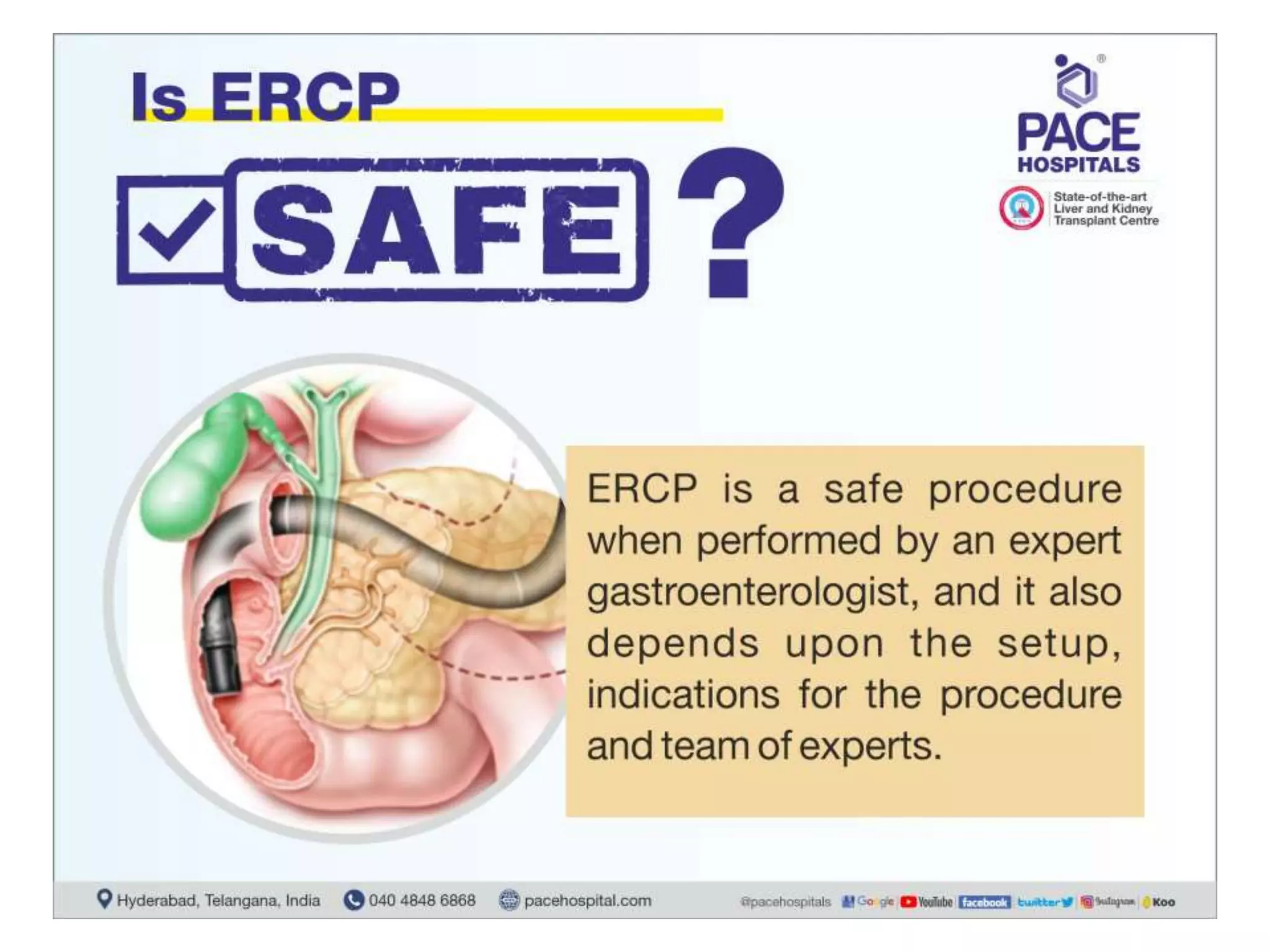 ERCP Procedure