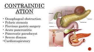 (ERCP) Cholangiopancreatography Bile ducts procedure | PPTX