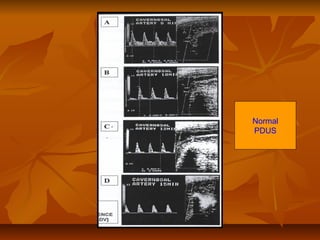 Normal Pdu Erctile dysfunction | PPT