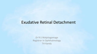 Exudative Retinal Detachment
Dr R S Walpitagamage
Registrar in Ophthalmology
TH Kandy
 