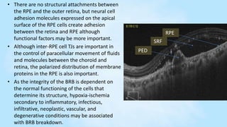 Exudative Retinal Detachment | PPTX