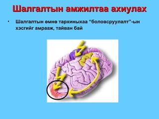 Шалгалтын өмнө тархиныхаа “боловсруулалт”-ын хэсгийг амрааж, тайван бай Шалгалтын амжилтаа ахиулах 