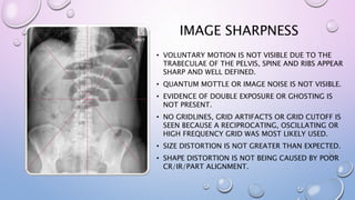 IMAGE SHARPNESS
• VOLUNTARY MOTION IS NOT VISIBLE DUE TO THE
TRABECULAE OF THE PELVIS, SPINE AND RIBS APPEAR
SHARP AND WELL DEFINED.
• QUANTUM MOTTLE OR IMAGE NOISE IS NOT VISIBLE.
• EVIDENCE OF DOUBLE EXPOSURE OR GHOSTING IS
NOT PRESENT.
• NO GRIDLINES, GRID ARTIFACTS OR GRID CUTOFF IS
SEEN BECAUSE A RECIPROCATING, OSCILLATING OR
HIGH FREQUENCY GRID WAS MOST LIKELY USED.
• SIZE DISTORTION IS NOT GREATER THAN EXPECTED.
• SHAPE DISTORTION IS NOT BEING CAUSED BY POOR
CR/IR/PART ALIGNMENT.
 