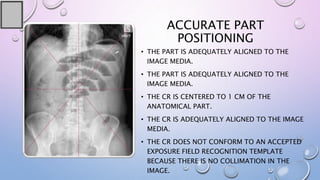 ACCURATE PART
POSITIONING
• THE PART IS ADEQUATELY ALIGNED TO THE
IMAGE MEDIA.
• THE PART IS ADEQUATELY ALIGNED TO THE
IMAGE MEDIA.
• THE CR IS CENTERED TO 1 CM OF THE
ANATOMICAL PART.
• THE CR IS ADEQUATELY ALIGNED TO THE IMAGE
MEDIA.
• THE CR DOES NOT CONFORM TO AN ACCEPTED
EXPOSURE FIELD RECOGNITION TEMPLATE
BECAUSE THERE IS NO COLLIMATION IN THE
IMAGE.
 