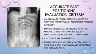 ACCURATE PART
POSITIONING:
EVALUATION CRITERIA
• AN ARROW OR “WORD” MARKER, INDICATING
THAT THE PATIENT WAS IN AN UPRIGHT POSITION
IS PRESENT.
• SPINOUS PROCESSES ARE ALIGNED WITH THE
MIDLINE OF THE VERTEBRAL BODIES, WITH
PEDICLES AT EQUAL DISTANCED FROM THEM.
• ILIAC WINGS ARE SYMMETRICAL
• EIGHTH THORACIC VERTEBRA, LATERAL BODY
SOFT TISSUE AND ILIAC WINGS ARE INCLUDED IN
THE EXPOSURE FIELD.
 