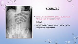 SOURCES
• HTTP://LIFEINTHEFASTLANE.COM/INVESTIG
ATIONS/AXR-INTERPRETATION/
• EVOLVE
• RADIOGRAPHIC IMAGE ANALYSIS BY KATHY
MCQUILLEN MARTENSEN
 