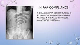 HIPAA COMPLIANCE
• THE IMAGE IS HIPAA COMPLIANT. THERE IS
NO PATIENT OR HOSPITAL INFORMATION
INCLUDED IN THE IMAGE THAT WOULD
VIOLATE HIPAA PROTOCOLS.
 