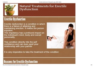 5/26/2014 Erectile-dysfunction-infographic.jpeg (800×3695)
file:///home/brijesh/Erectile-dysfunction-infographic.jpeg 1/6
 