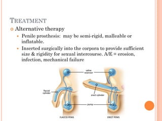 TREATMENT
   Alternative therapy
       Penile prosthesis: may be semi-rigid, malleable or
        inflatable.
       Inserted surgically into the corpora to provide sufficient
        size & rigidity for sexual intercourse. A/E = erosion,
        infection, mechanical failure
 