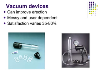 Vacuum devices Can improve erection Messy and user dependent Satisfaction varies 35-80% 