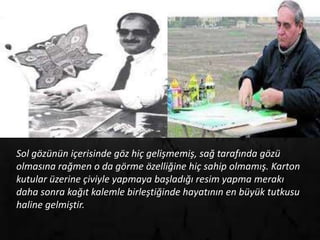 Sol gözünün içerisinde göz hiç gelişmemiş, sağ tarafında gözü
olmasına rağmen o da görme özelliğine hiç sahip olmamış. Karton
kutular üzerine çiviyle yapmaya başladığı resim yapma merakı
daha sonra kağıt kalemle birleştiğinde hayatının en büyük tutkusu
haline gelmiştir.
 