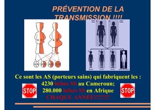 PRÉVENTION DE LA
TRANSMISSION !!!!
Ce sont les AS (porteurs sains) qui fabriquent les :
4230 bébés SS au Cameroun;
280.000 bébés SS en Afrique
CHAQUE ANNÉE!!!!!!!!