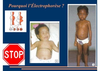 Pourquoi l’Électrophorèse ?