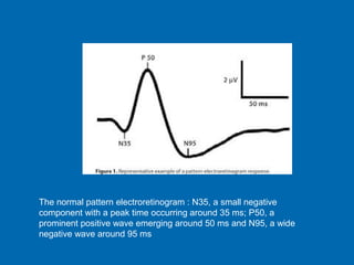 Erg | PPT