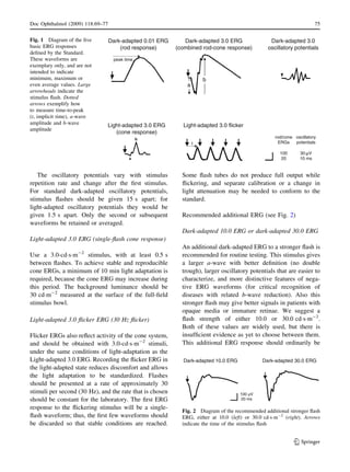 The oscillatory potentials vary with stimulus
repetition rate and change after the ﬁrst stimulus.
For standard dark-adapted oscillatory potentials,
stimulus ﬂashes should be given 15 s apart; for
light-adapted oscillatory potentials they would be
given 1.5 s apart. Only the second or subsequent
waveforms be retained or averaged.
Light-adapted 3.0 ERG (single-ﬂash cone response)
Use a 3.0-cdÁsÁm-2
stimulus, with at least 0.5 s
between ﬂashes. To achieve stable and reproducible
cone ERGs, a minimum of 10 min light adaptation is
required, because the cone ERG may increase during
this period. The background luminance should be
30 cdÁm-2
measured at the surface of the full-ﬁeld
stimulus bowl.
Light-adapted 3.0 ﬂicker ERG (30 Hz ﬂicker)
Flicker ERGs also reﬂect activity of the cone system,
and should be obtained with 3.0-cdÁsÁm-2
stimuli,
under the same conditions of light-adaptation as the
Light-adapted 3.0 ERG. Recording the ﬂicker ERG in
the light-adapted state reduces discomfort and allows
the light adaptation to be standardized. Flashes
should be presented at a rate of approximately 30
stimuli per second (30 Hz), and the rate that is chosen
should be constant for the laboratory. The ﬁrst ERG
response to the ﬂickering stimulus will be a single-
ﬂash waveform; thus, the ﬁrst few waveforms should
be discarded so that stable conditions are reached.
Some ﬂash tubes do not produce full output while
ﬂickering, and separate calibration or a change in
light attenuation may be needed to conform to the
standard.
Recommended additional ERG (see Fig. 2)
Dark-adapted 10.0 ERG or dark-adapted 30.0 ERG
An additional dark-adapted ERG to a stronger ﬂash is
recommended for routine testing. This stimulus gives
a larger a-wave with better deﬁnition (no double
trough), larger oscillatory potentials that are easier to
characterize, and more distinctive features of nega-
tive ERG waveforms (for critical recognition of
diseases with related b-wave reduction). Also this
stronger ﬂash may give better signals in patients with
opaque media or immature retinae. We suggest a
ﬂash strength of either 10.0 or 30.0 cdÁsÁm-2
.
Both of these values are widely used, but there is
insufﬁcient evidence as yet to choose between them.
This additional ERG response should ordinarily be
Dark-adapted 0.01 ERG
(rod response)
Dark-adapted 3.0
oscillatory potentials
Light-adapted 3.0 ERG
(cone response)
Light-adapted 3.0 flicker
a
b
oscillatory
potentials
30 V
10 ms
rod/cone
ERGs
100
20
peak time
Dark-adapted 3.0 ERG
(combined rod-cone response)
t
Fig. 1 Diagram of the ﬁve
basic ERG responses
deﬁned by the Standard.
These waveforms are
exemplary only, and are not
intended to indicate
minimum, maximum or
even average values. Large
arrowheads indicate the
stimulus ﬂash. Dotted
arrows exemplify how
to measure time-to-peak
(t, implicit time), a-wave
amplitude and b-wave
amplitude
100 V
20 ms
Dark-adapted 10.0 ERG Dark-adapted 30.0 ERG
Fig. 2 Diagram of the recommended additional stronger ﬂash
ERG, either at 10.0 (left) or 30.0 cdÁsÁm-2
(right). Arrows
indicate the time of the stimulus ﬂash
Doc Ophthalmol (2009) 118:69–77 75
123
 