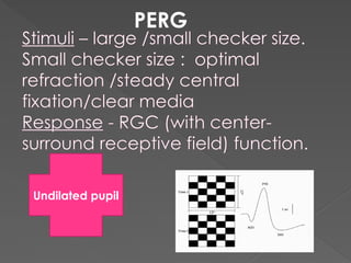 Pattern Erg Rgc ERG electroretinogram principle,methods,measurement parameters,diseases ...