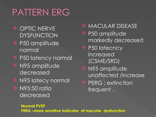 ERG electroretinogram principle,methods,measurement parameters,diseases ...