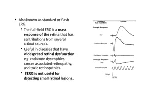 ELECTRORETINOGRAM - use and applications in ophthalmology | PPTX