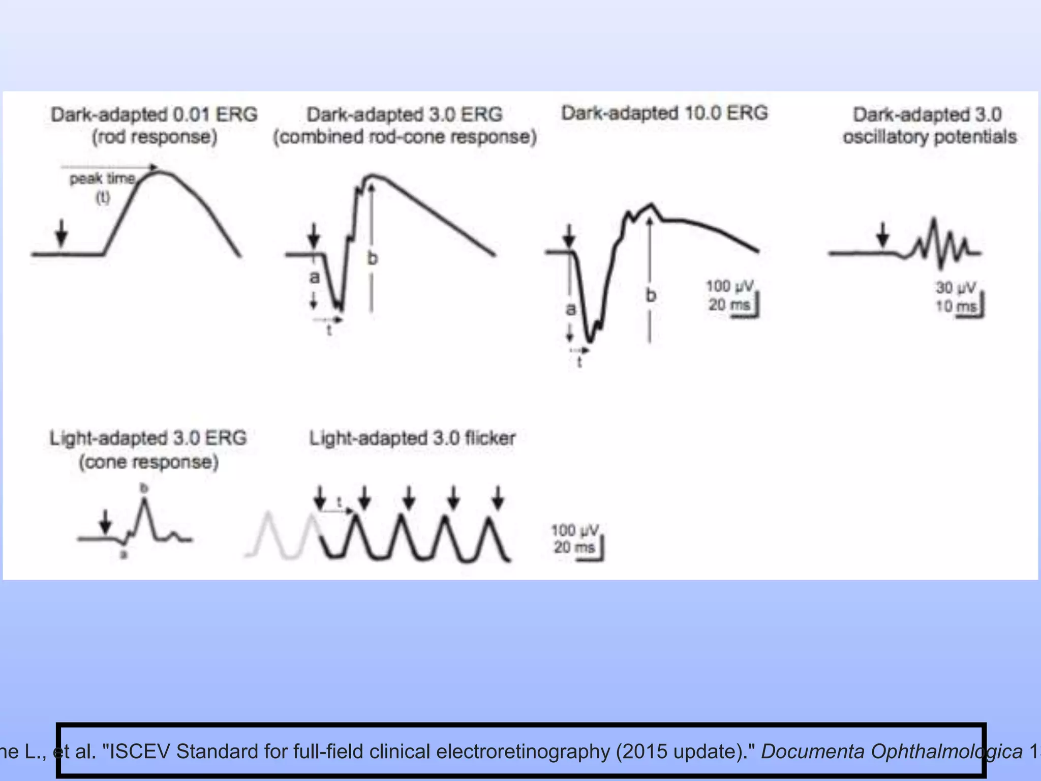 Electrophysiology (ERG and EOG) Simplified........ | PPTX