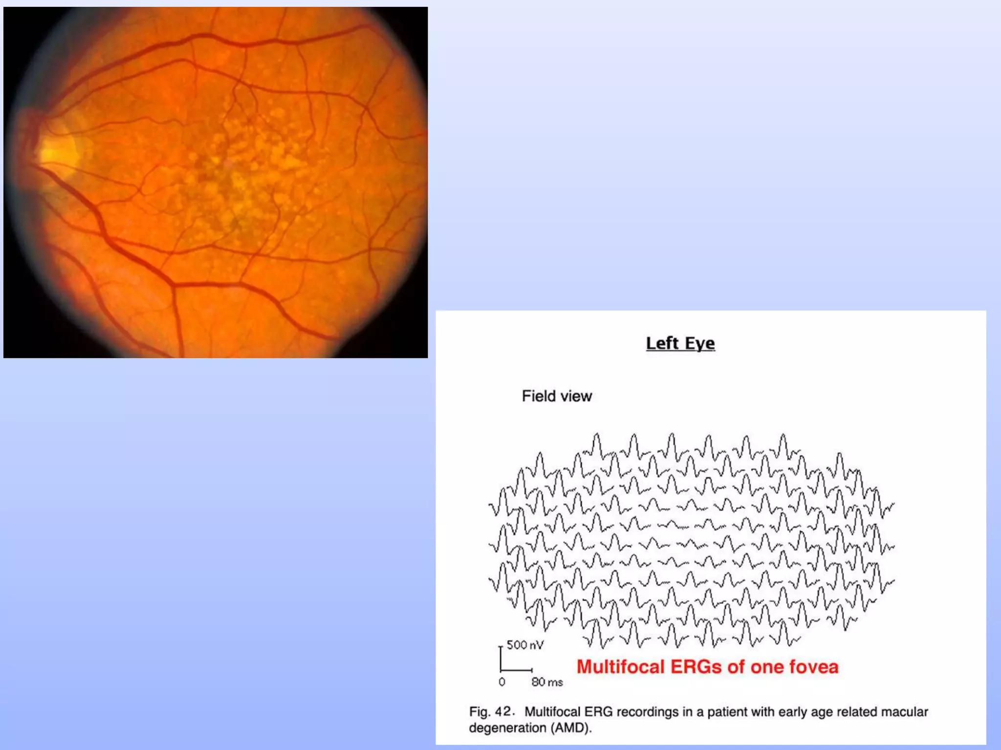 Electrophysiology (ERG and EOG) Simplified........ | PPTX
