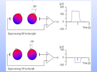 Eogi Problem Electrophysiology (ERG and EOG) Simplified........ | PPTX