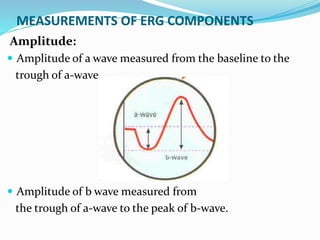 MEASUREMENTS OF ERG COMPONENTS
Amplitude:
 Amplitude of a wave measured from the baseline to the
trough of a-wave.
 Amplitude of b wave measured from
the trough of a-wave to the peak of b-wave.
 