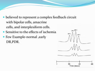  believed to represent a complex feedback circuit
with bipolar cells, amacrine
cells, and interplexiform cells.
 Sensitive to the effects of ischemia.
 Few Example-normal ,early
DR,PDR.
 