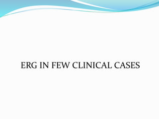ERG IN FEW CLINICAL CASES
 