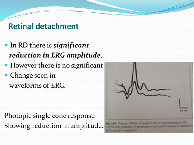 Erg and eog | PPTX | Eye and Vision Conditions | Diseases and Conditions
