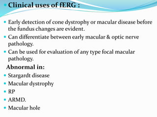  Clinical uses of fERG :
 Early detection of cone dystrophy or macular disease before
the fundus changes are evident.
 Can differentiate between early macular & optic nerve
pathology.
 Can be used for evaluation of any type focal macular
pathology.
Abnormal in:
 Stargardt disease
 Macular dystrophy
 RP
 ARMD.
 Macular hole
 