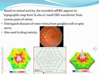  Based on retinal activity, the recorded mfERG appears in
‘topographic map form’ & also in ‘small ERG waveforms’ from
various parts of retina.
 Distinguish diseases of outer retina from ganglion cell or optic
nerve.
 Also used in drug toxicity .
 