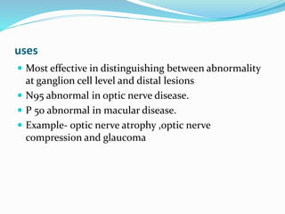 uses
 Most effective in distinguishing between abnormality
at ganglion cell level and distal lesions
 N95 abnormal in optic nerve disease.
 P 50 abnormal in macular disease.
 Example- optic nerve atrophy ,optic nerve
compression and glaucoma
 