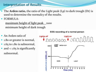 Interpretation of Results
 The Arden ratio, the ratio of the Light peak (Lp) to dark trough (Dt) is
used to determine the normalcy of the results.
 FORMULA-
maximum height of light peak x100
minimum height of dark trough
 An Arden ratio of
 1.80 or greater is normal,
 1.65 to 1.80 is subnormal,
 and < 1.65 is significantly
subnormal.
AMPLITUDEOF
 