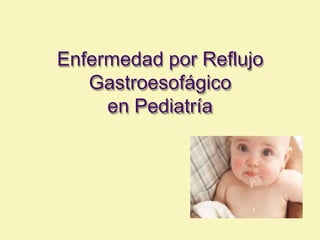 Enfermedad por Reflujo
Gastroesofágico
en Pediatría
 
