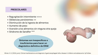 Sandifer Reflex ERGE- reflujo esofagico en pediatria.pdf